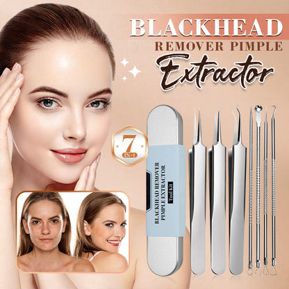 💓Letzter Tag 50% RABATT💥Edelstahl Mitesser Entferner Werkzeug-Set